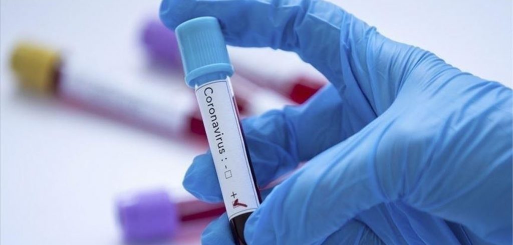Covid-19 - coronavirus - Le point sur la pandémie - ministère de la Santé Tunisie